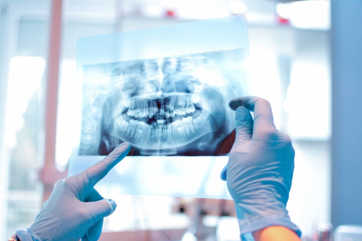 Dental X-Rays: Why They’re Important for Your Dental Health